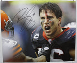 Brian Cushing Autographed 20x24 Bloody Face Canvas- TriStar Authenticated