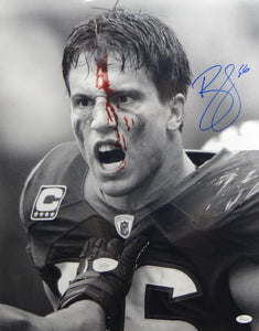 Brian Cushing Signed Texans 16x20 B&W Bloody Face Photo- JSA W Auth *Blue