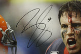 Brian Cushing Autographed 20x24 Bloody Face Canvas- TriStar Authenticated